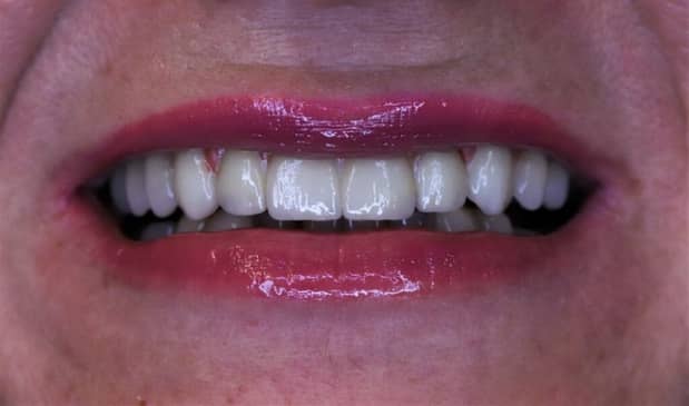 Slider image (2) Dentech Dental Centar